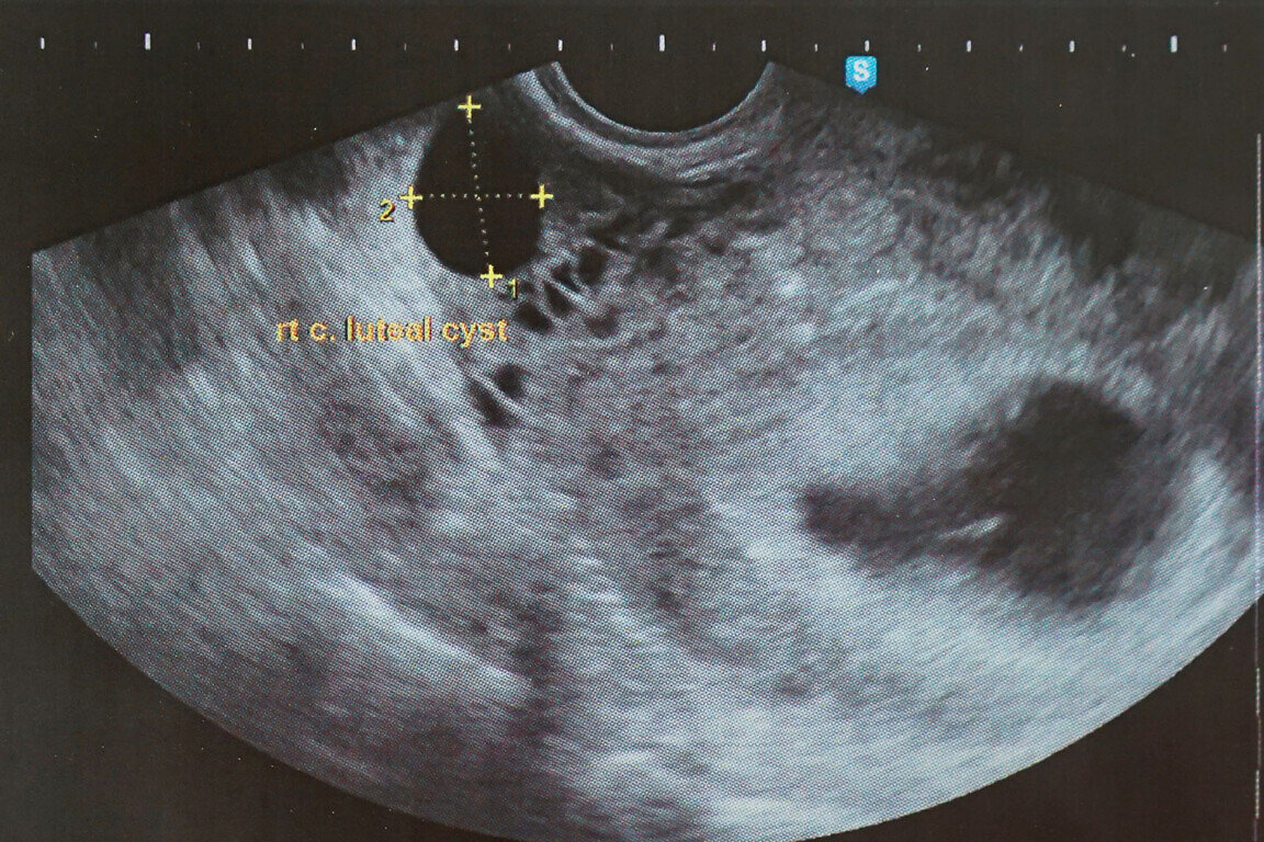 ultrasound imaging and reporting software