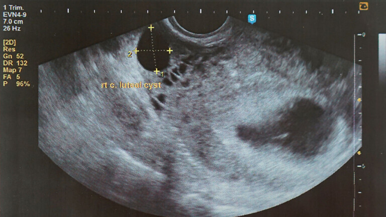 ultrasound imaging and reporting software