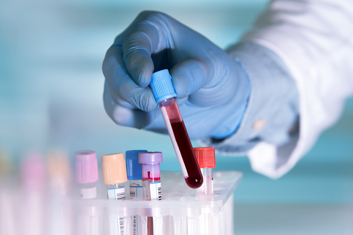 Blood test