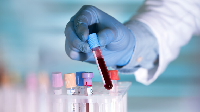 Blood test