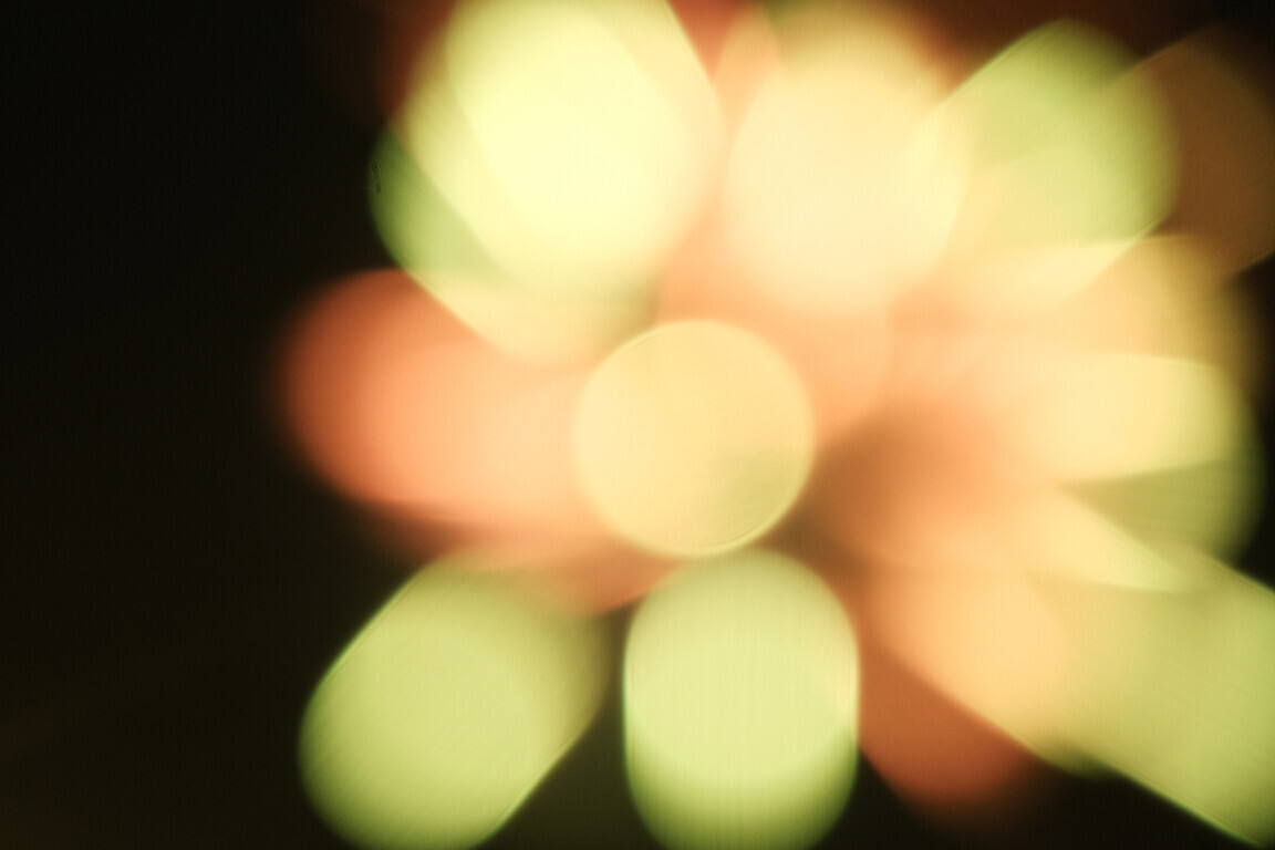 Eye vision getting blurry cause by health problem