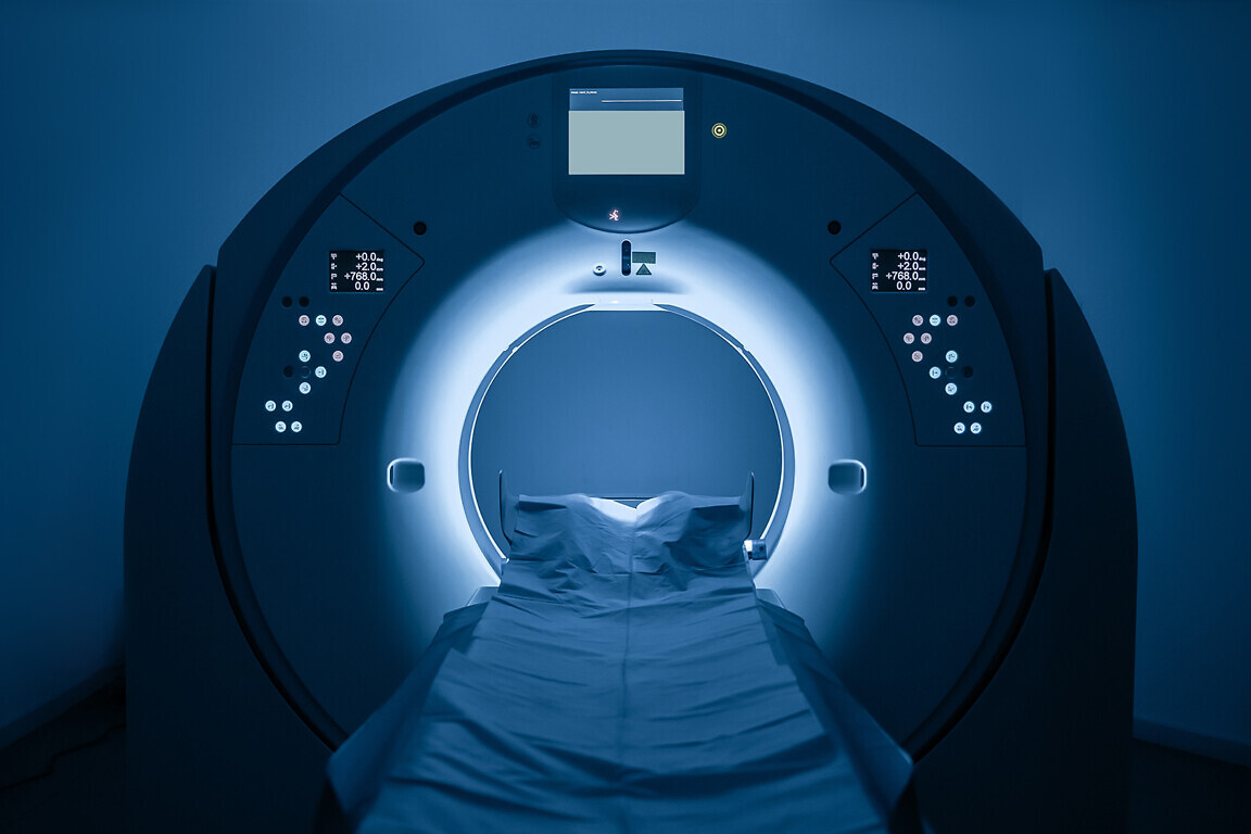 MRI Scan