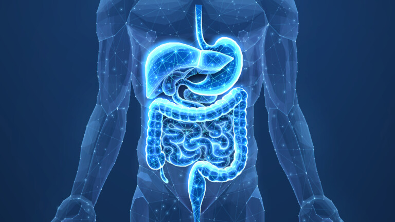 Bowel cancer
