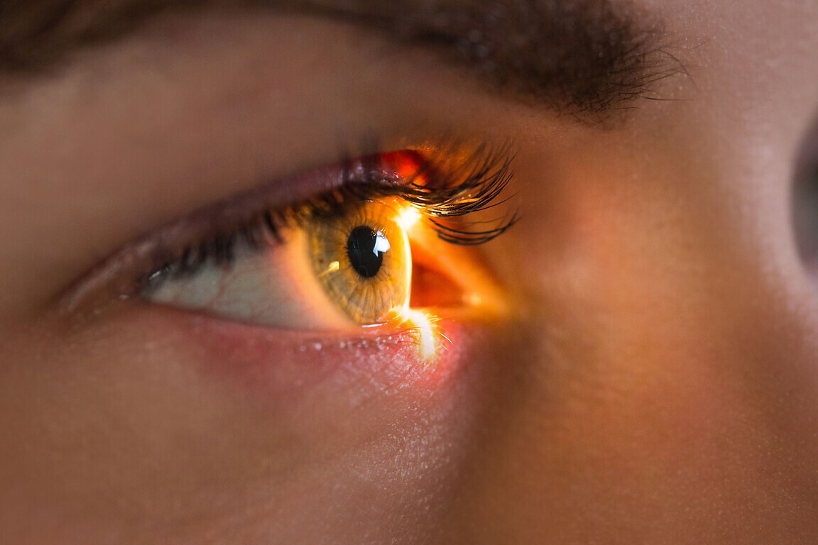 ophthalmology
