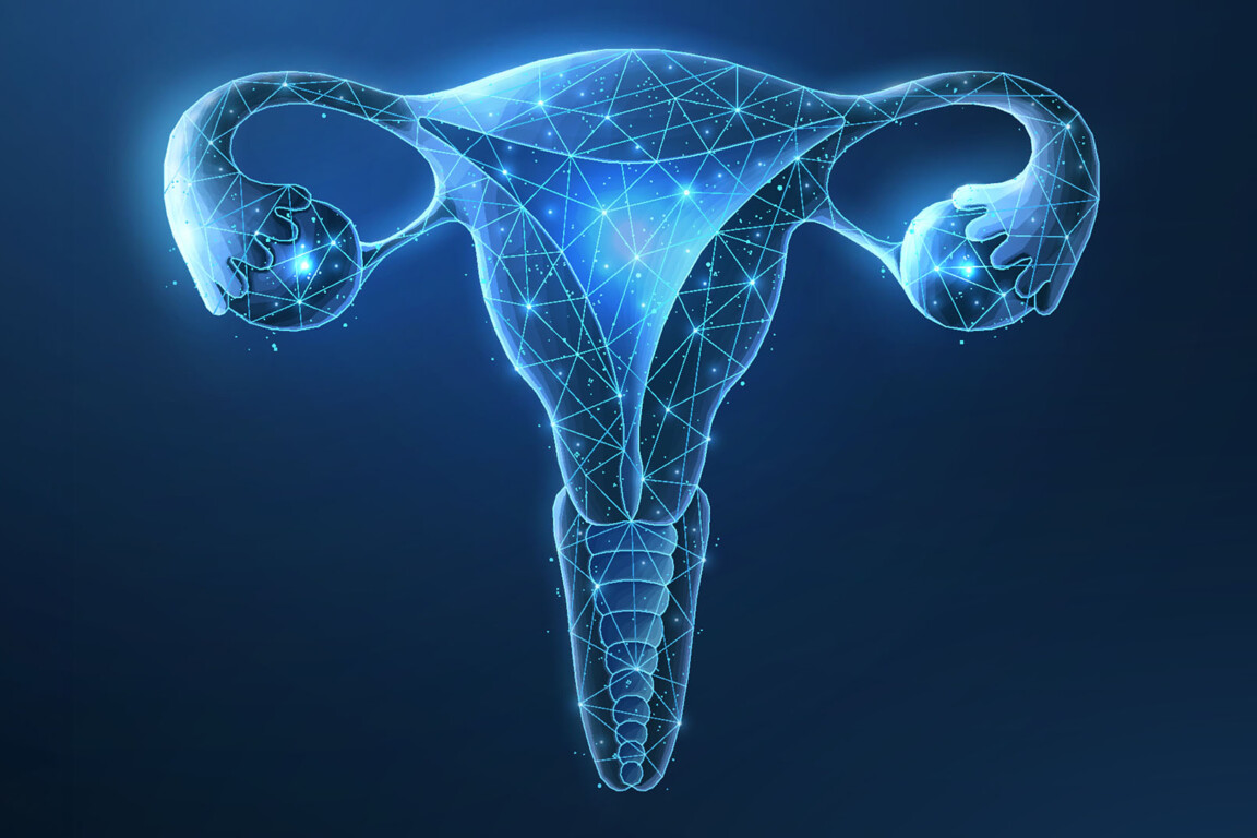 Ovarian cancer AI