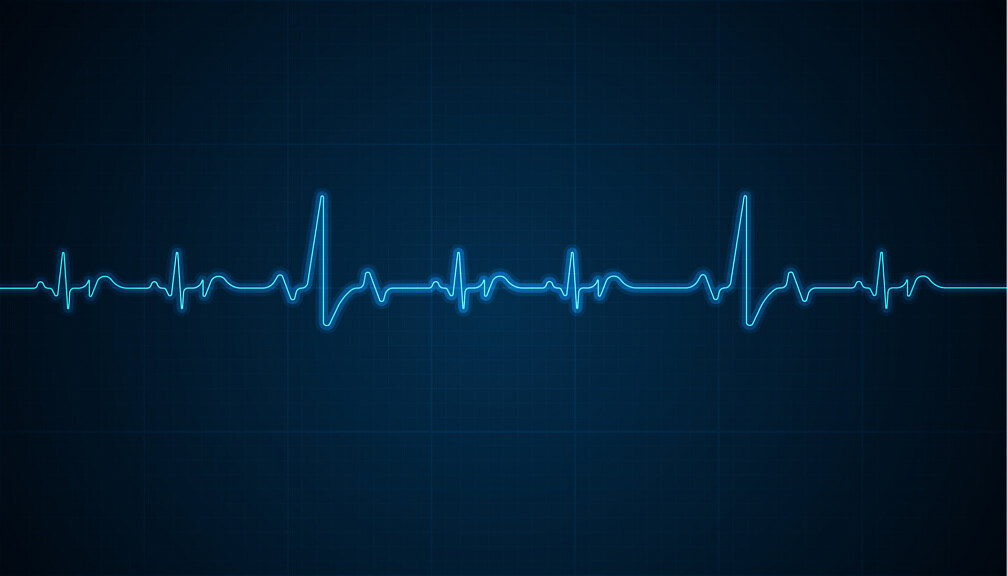 Heart rhythm