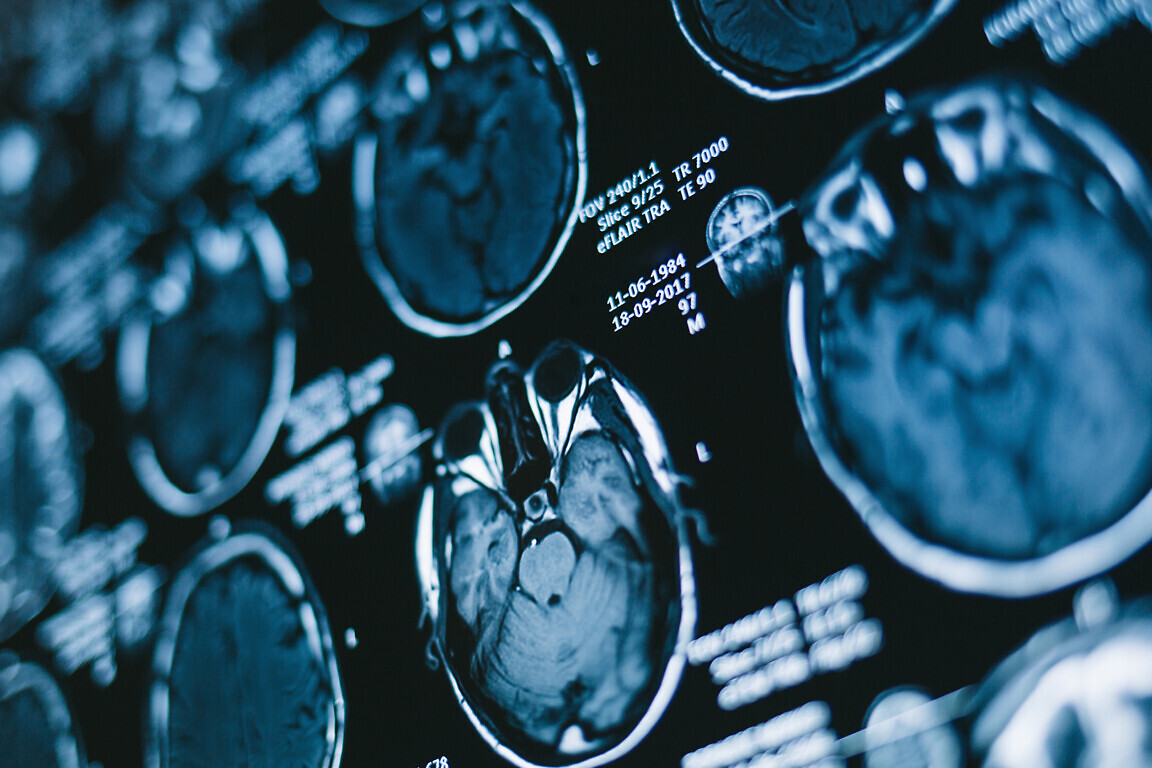 Magnetic resonance scan of the brain. Medicine, science