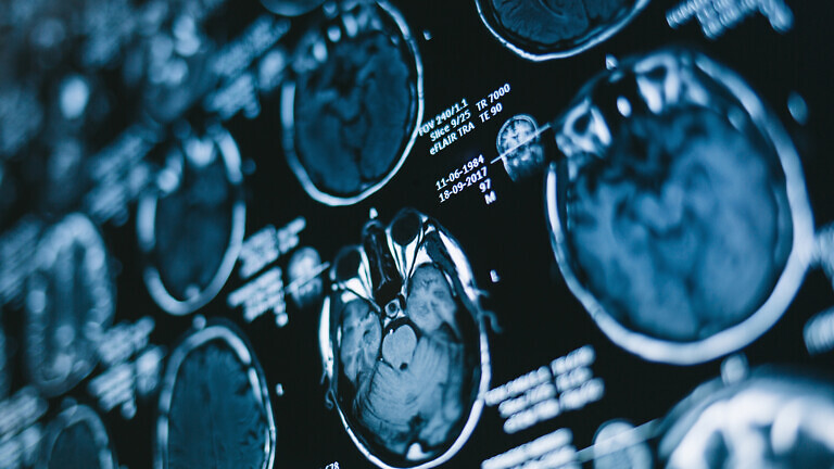 Magnetic resonance scan of the brain. Medicine, science