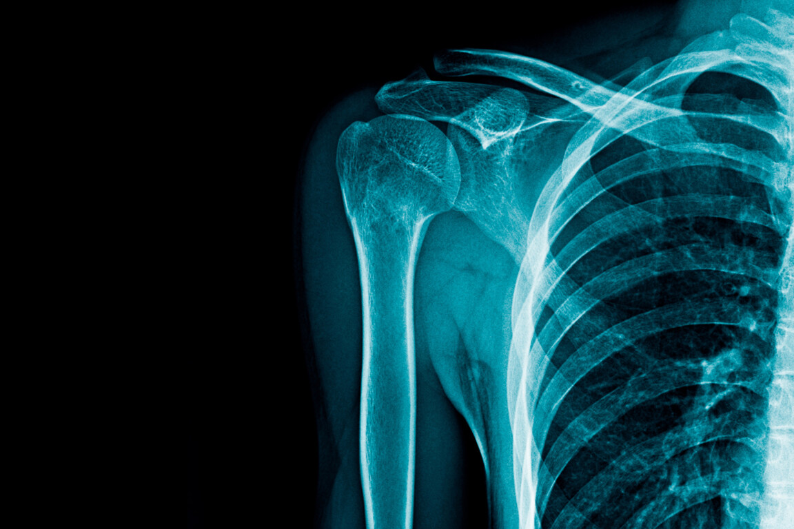 Radiology