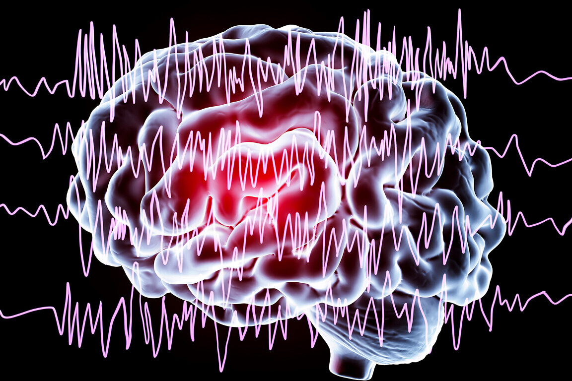 Epilepsy awareness concept