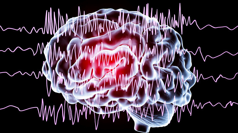 Epilepsy awareness concept
