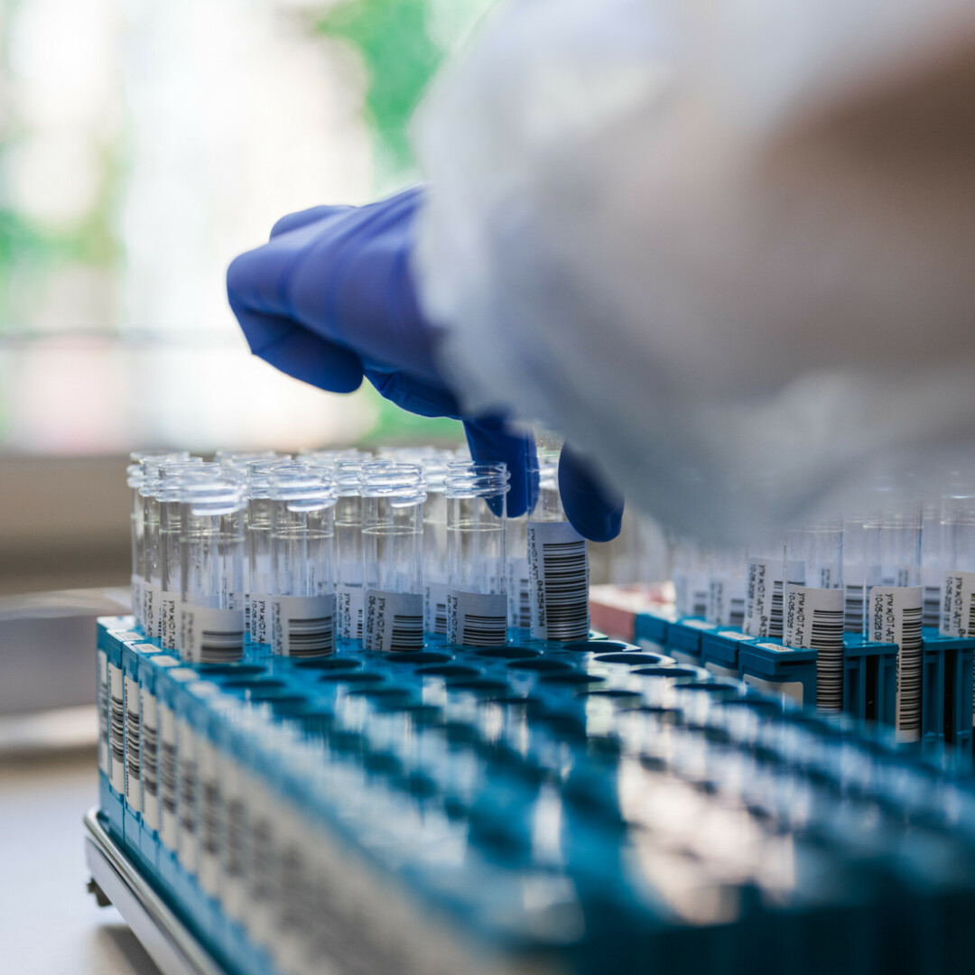 Vaccine research