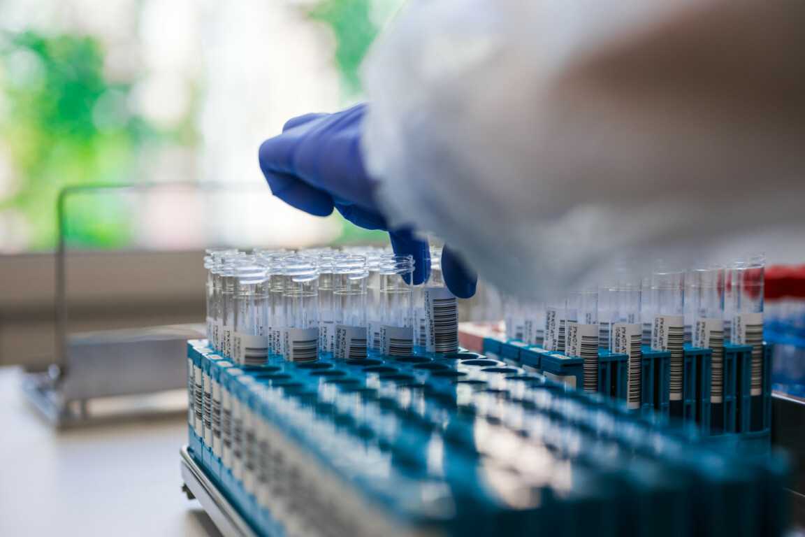 Vaccine research