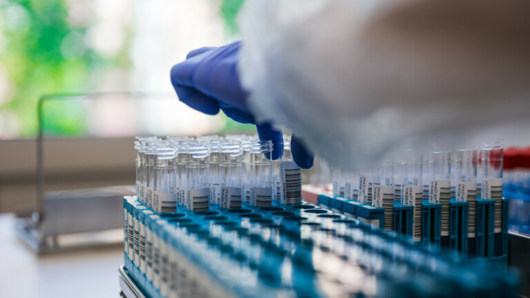 Vaccine research