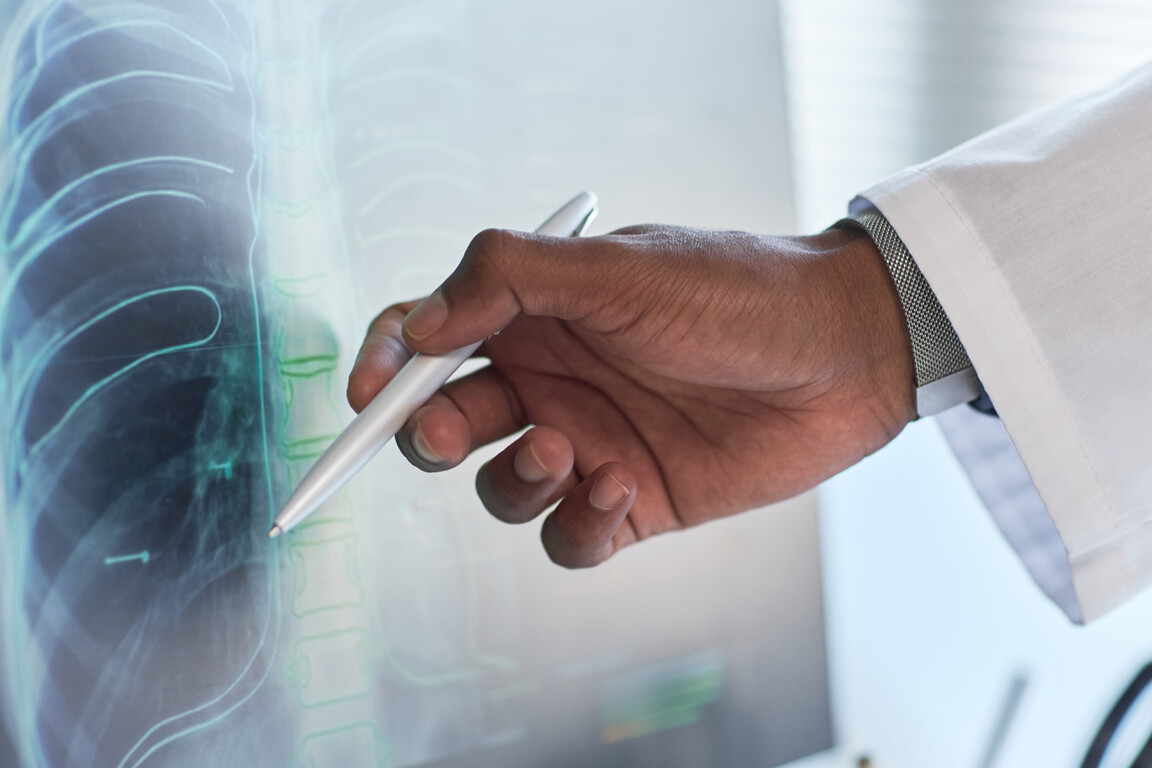 Monitoring the risks of AI embedded in healthcare