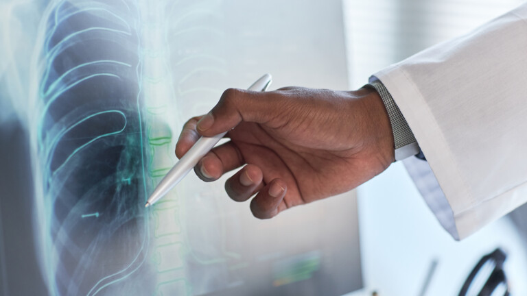 Monitoring the risks of AI embedded in healthcare
