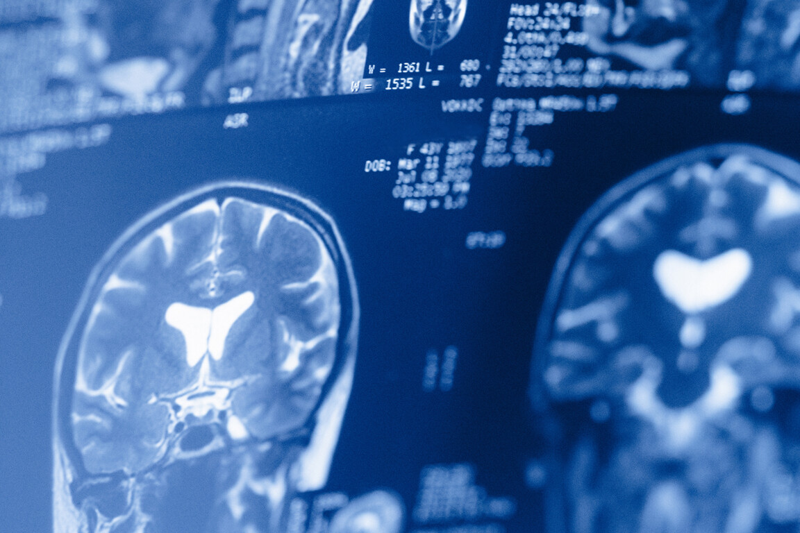 Neurology