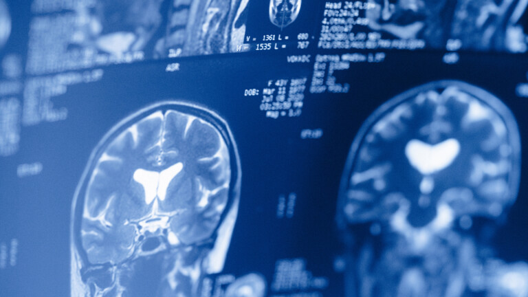 Neurology