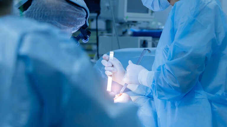 Surgical team performing umbilical hernia removal.