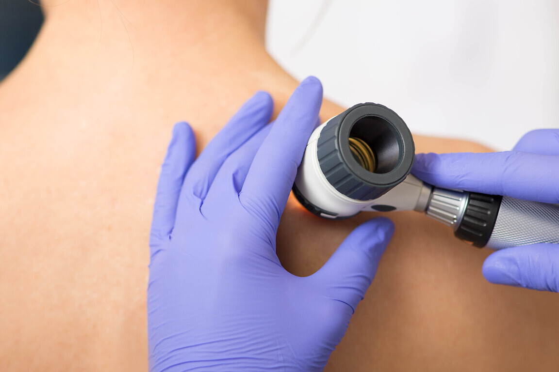 Dermatology