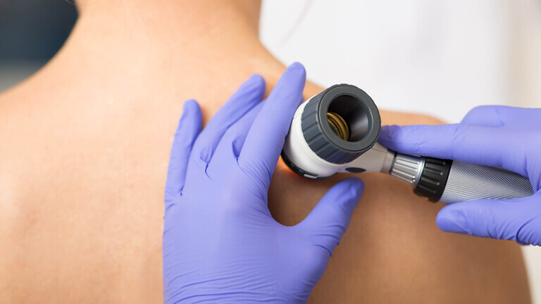 Dermatology