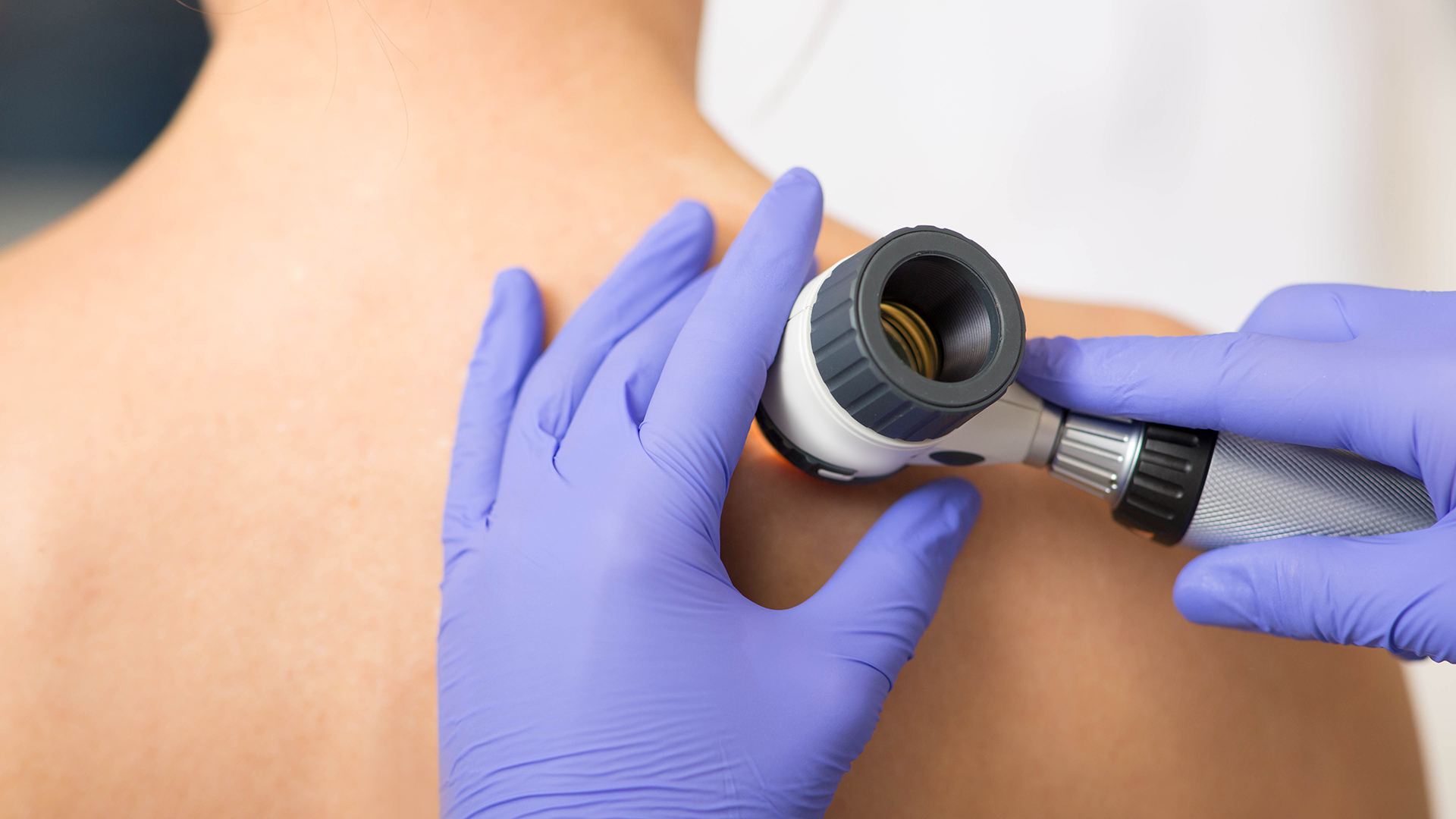 Innovation in healthcare roundup: Remote skin assessment, video rehab tool