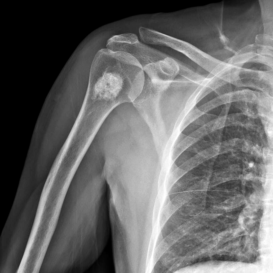 Musculoskeletal health