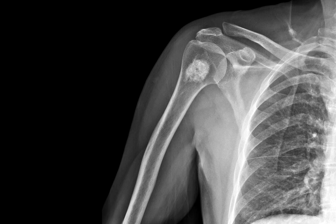 Musculoskeletal health