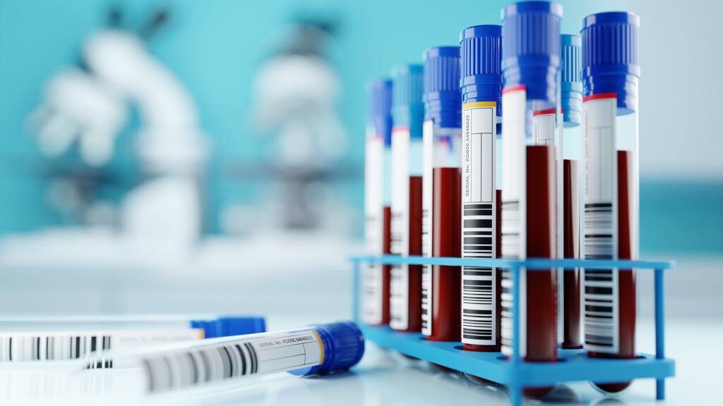 Blood test