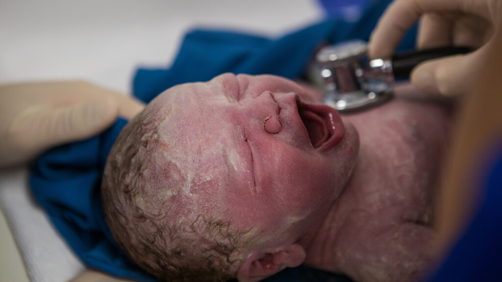 Close up image of a newly born.