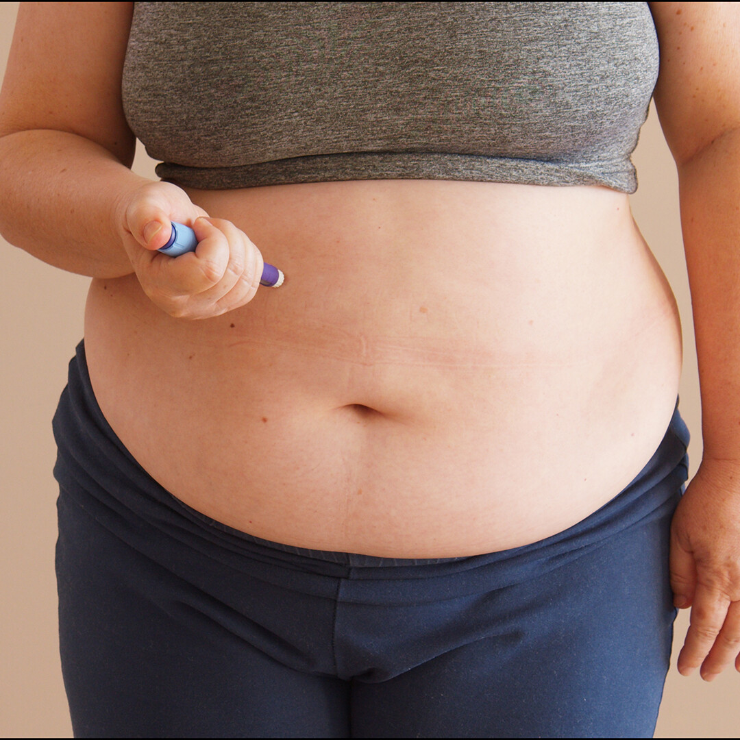 Weight management