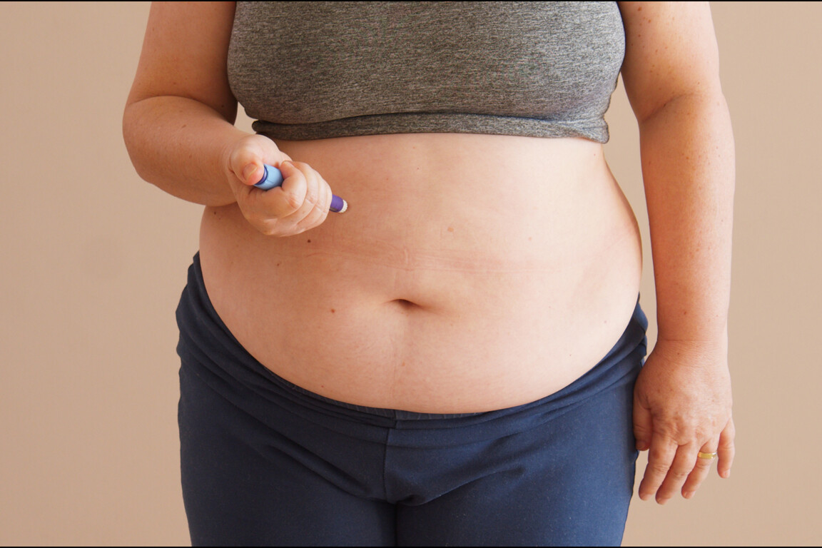 Weight management