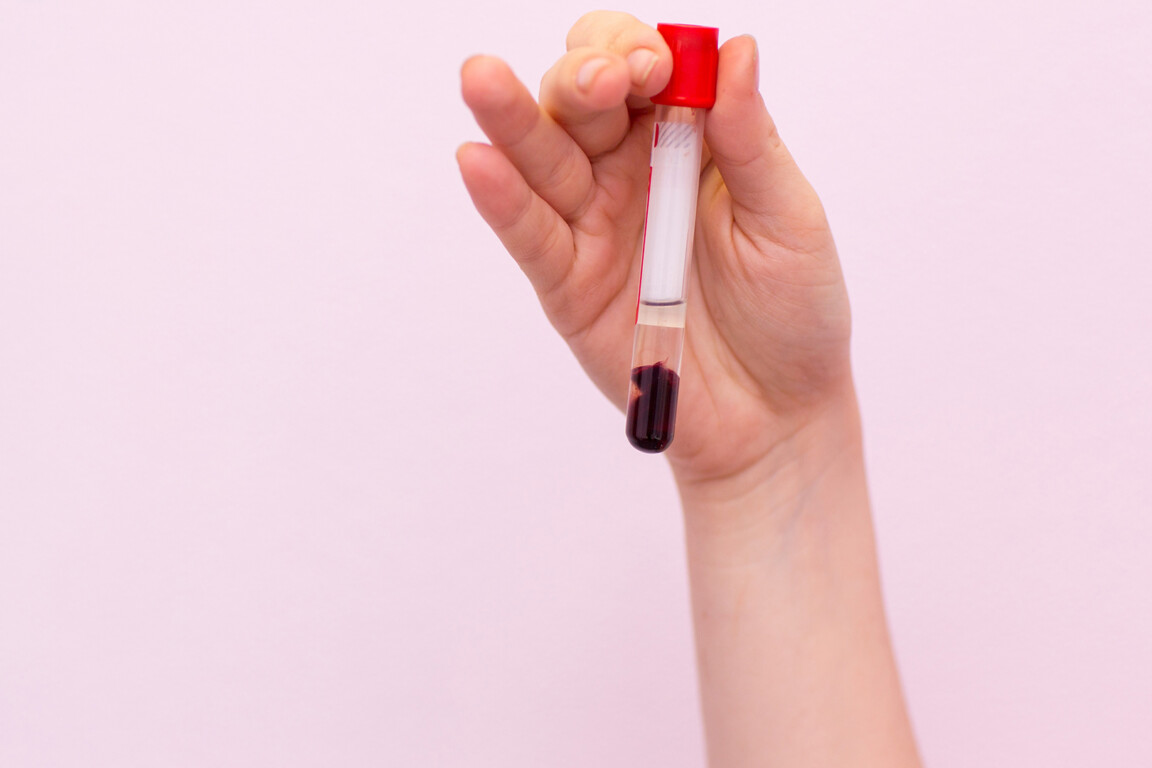 Breast cancer blood test can predict treatment response
