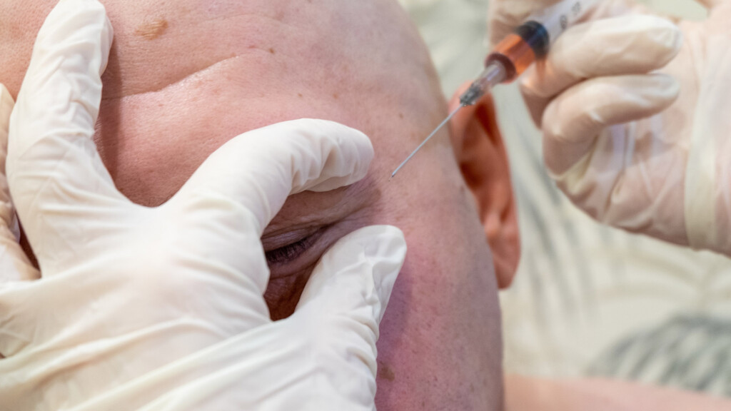 Non-surgical cosmetic procedure