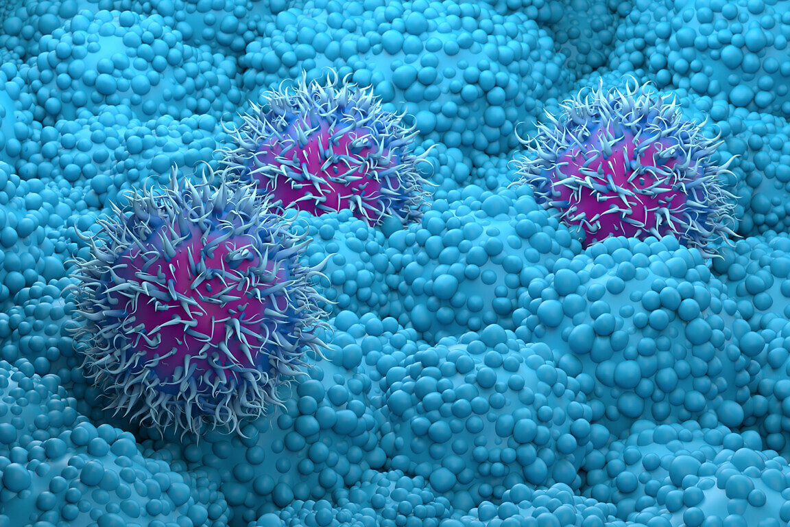 Pancreatic cancer cells closeup