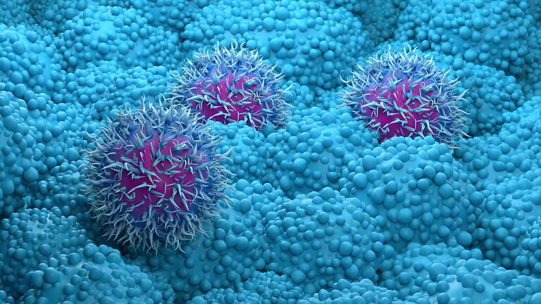 Pancreatic cancer cells closeup