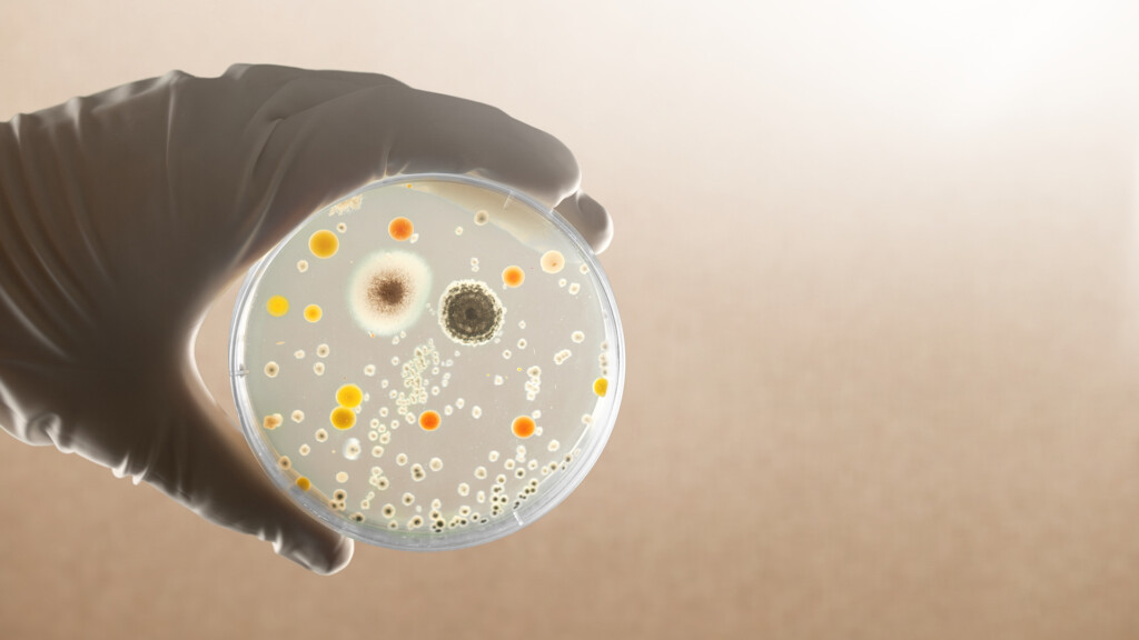 Antimicrobial resistance
