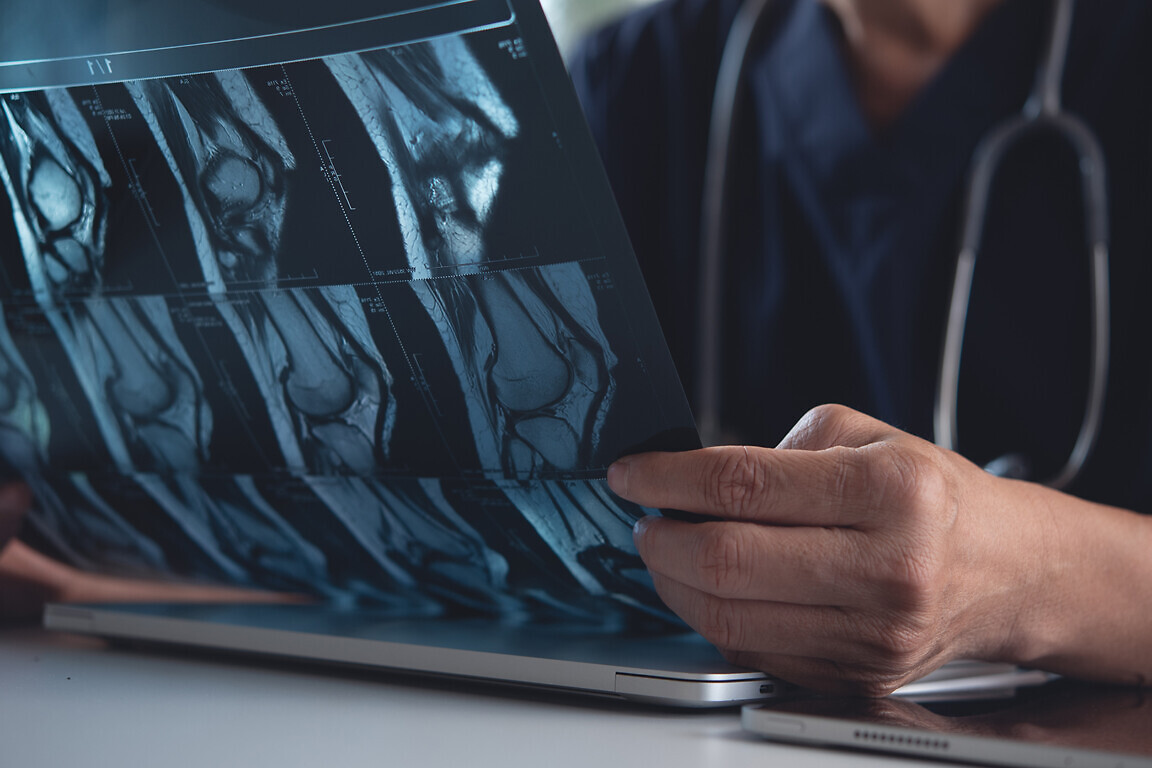 Doctor holding and looking patient bone x-ray film before surger