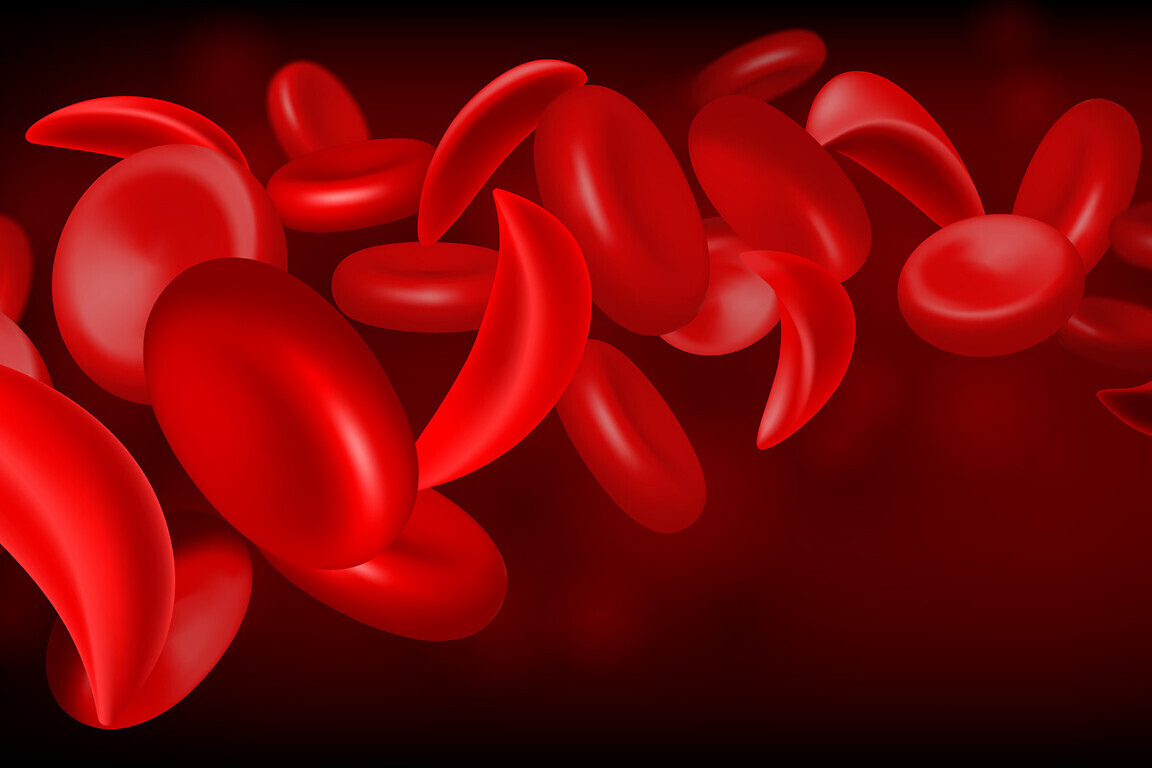 Normal red blood cell and sickle cell flow inside in artery. Medical concept. Vector illustration