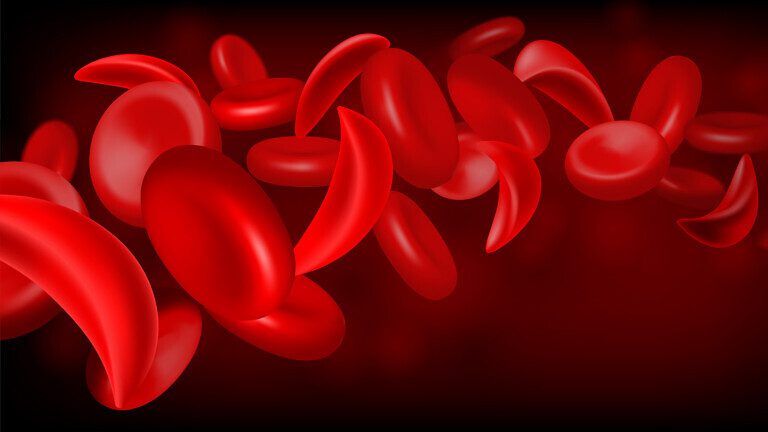 Normal red blood cell and sickle cell flow inside in artery. Medical concept. Vector illustration