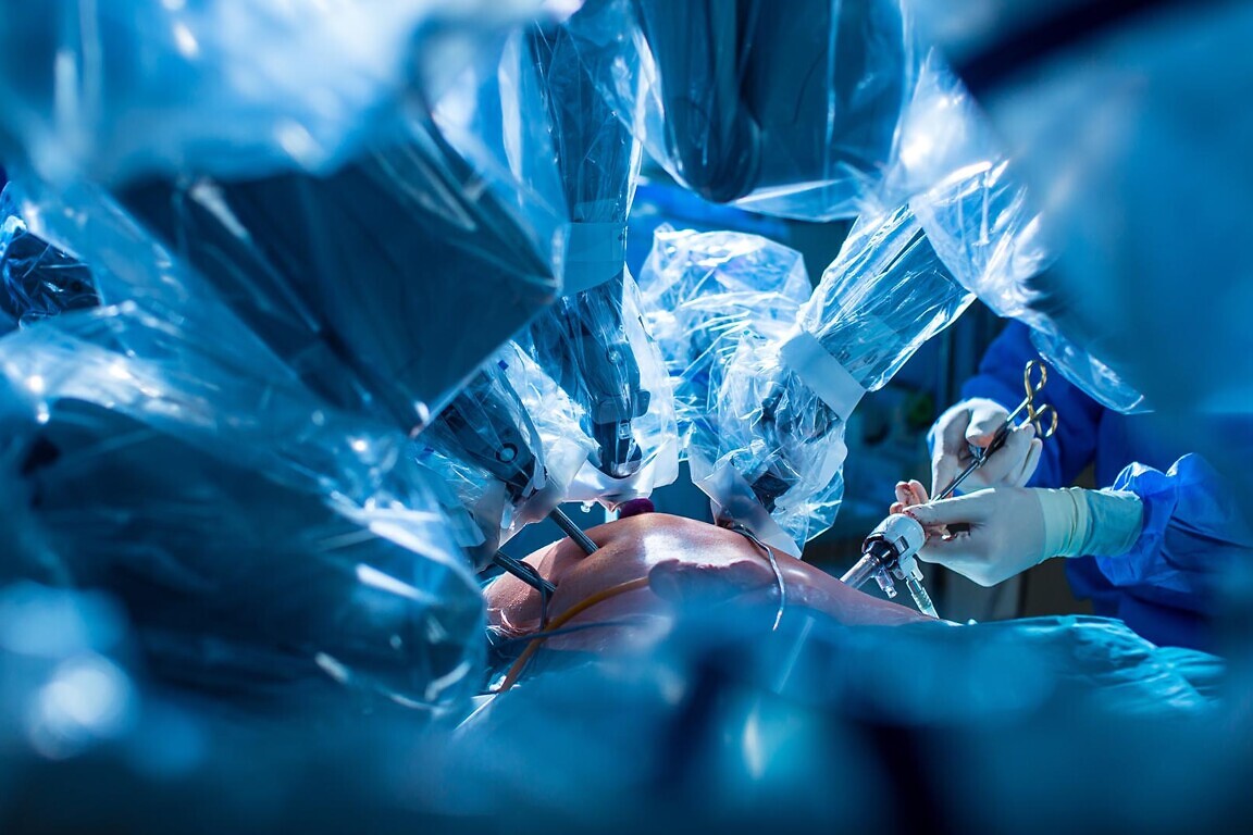 Surgery in a modern hospital being performed by a team of professionals (shallow DOF, color toned image)