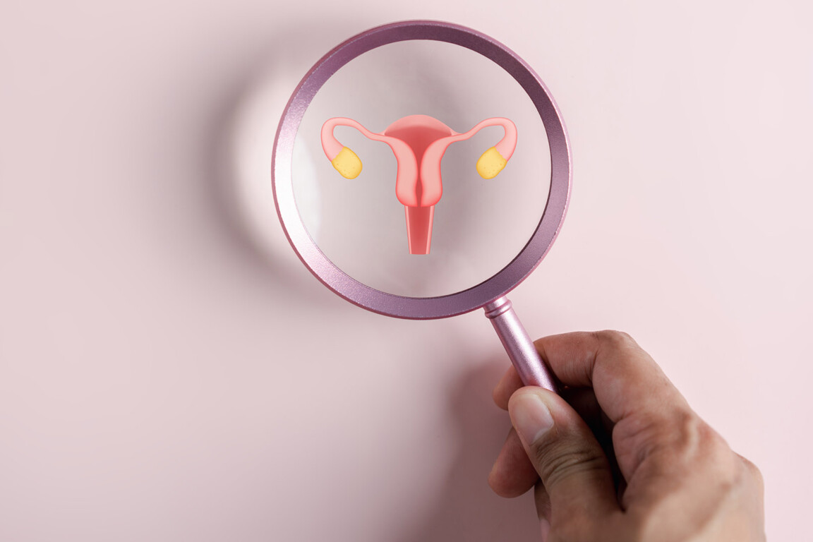 Ovarian cancer