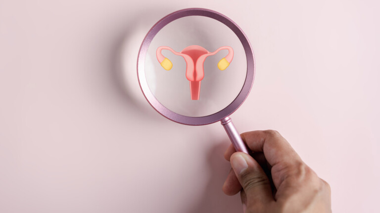 Ovarian cancer