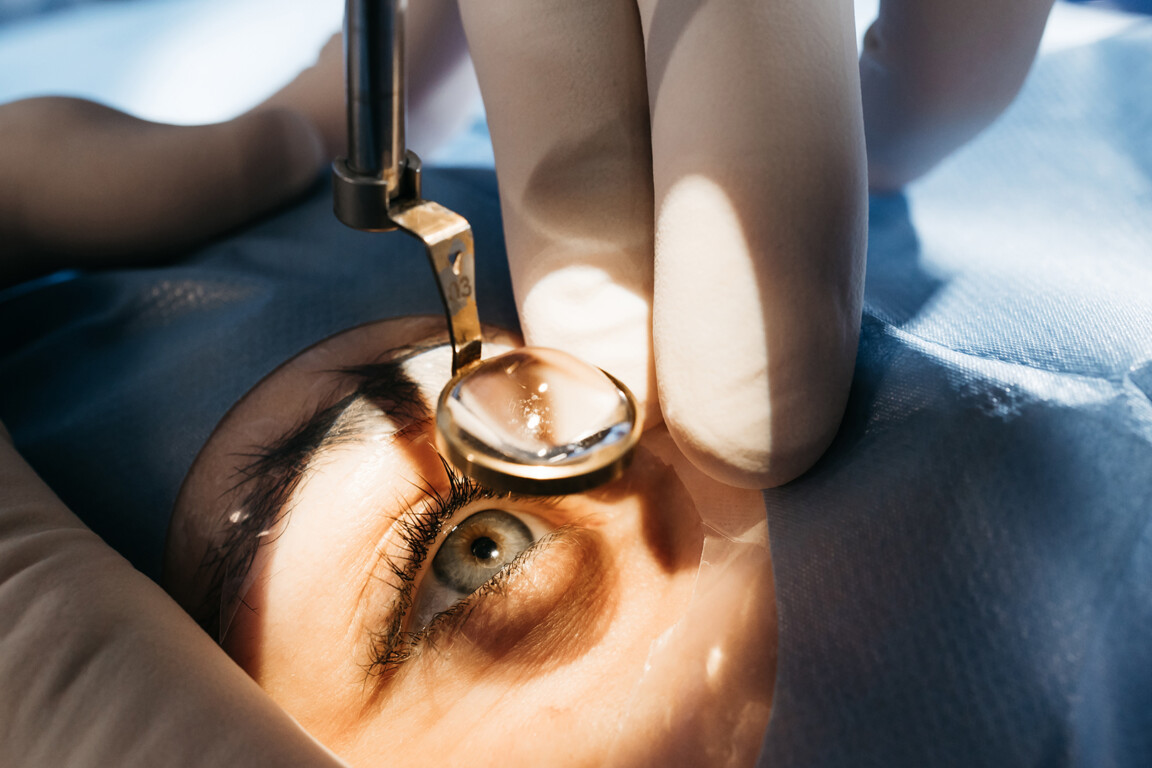 Cataract treatment