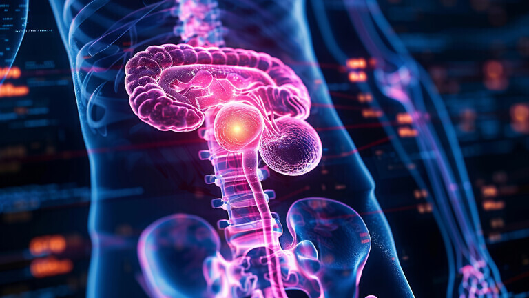 Bladder cancer