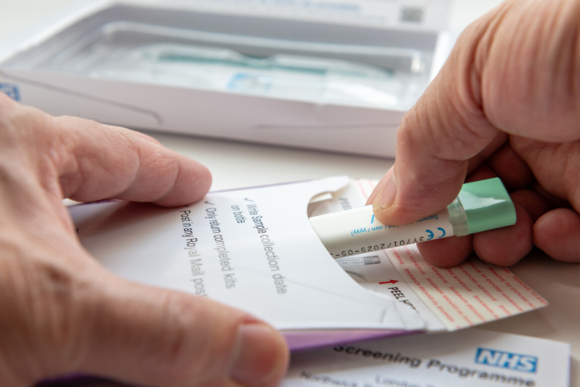 Bowel cancer test