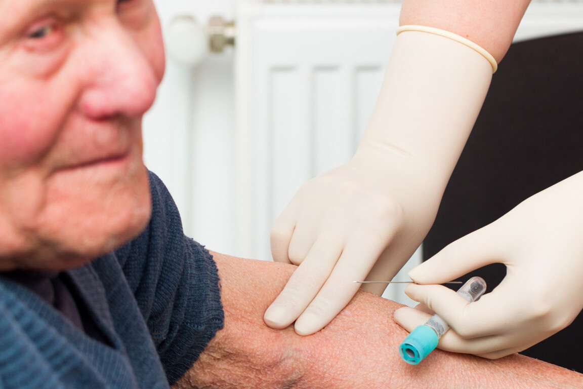 Alzheimer's research