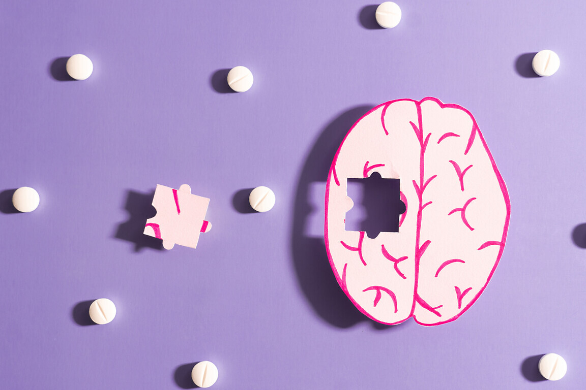 Human brain anatomy missing a piece of jigsaw puzzle with medicine pills on purple background. Treatment of Alzheimer's disease, Dementia and Parkinson disease concept. Mental health care.