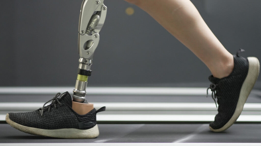 Lower-limb prosthesis
