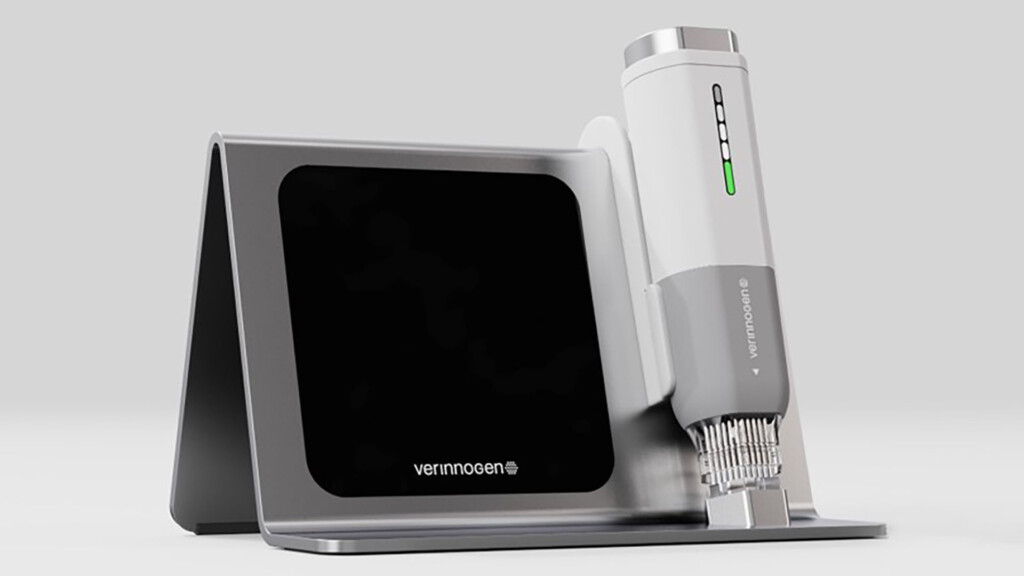 Verinnogen